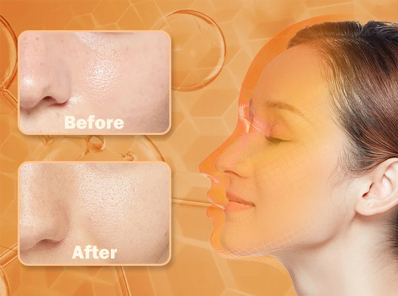 LED Photon Beauty Infrared Face and Neck Mask