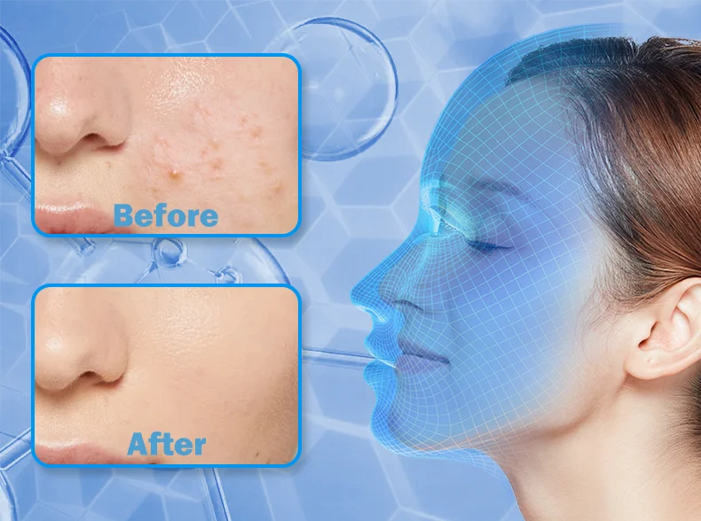 LED Photon Beauty Infrared Face and Neck Mask
