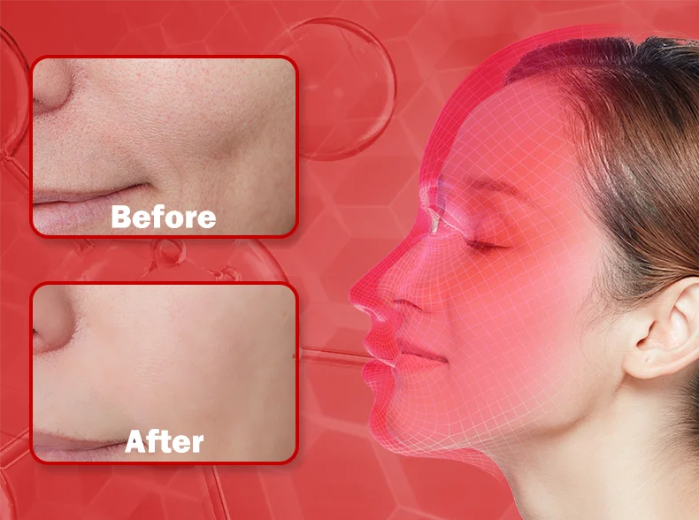 LED Photon Beauty Infrared Face and Neck Mask